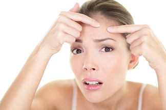 Wie du Mitesser endlich los wirst!