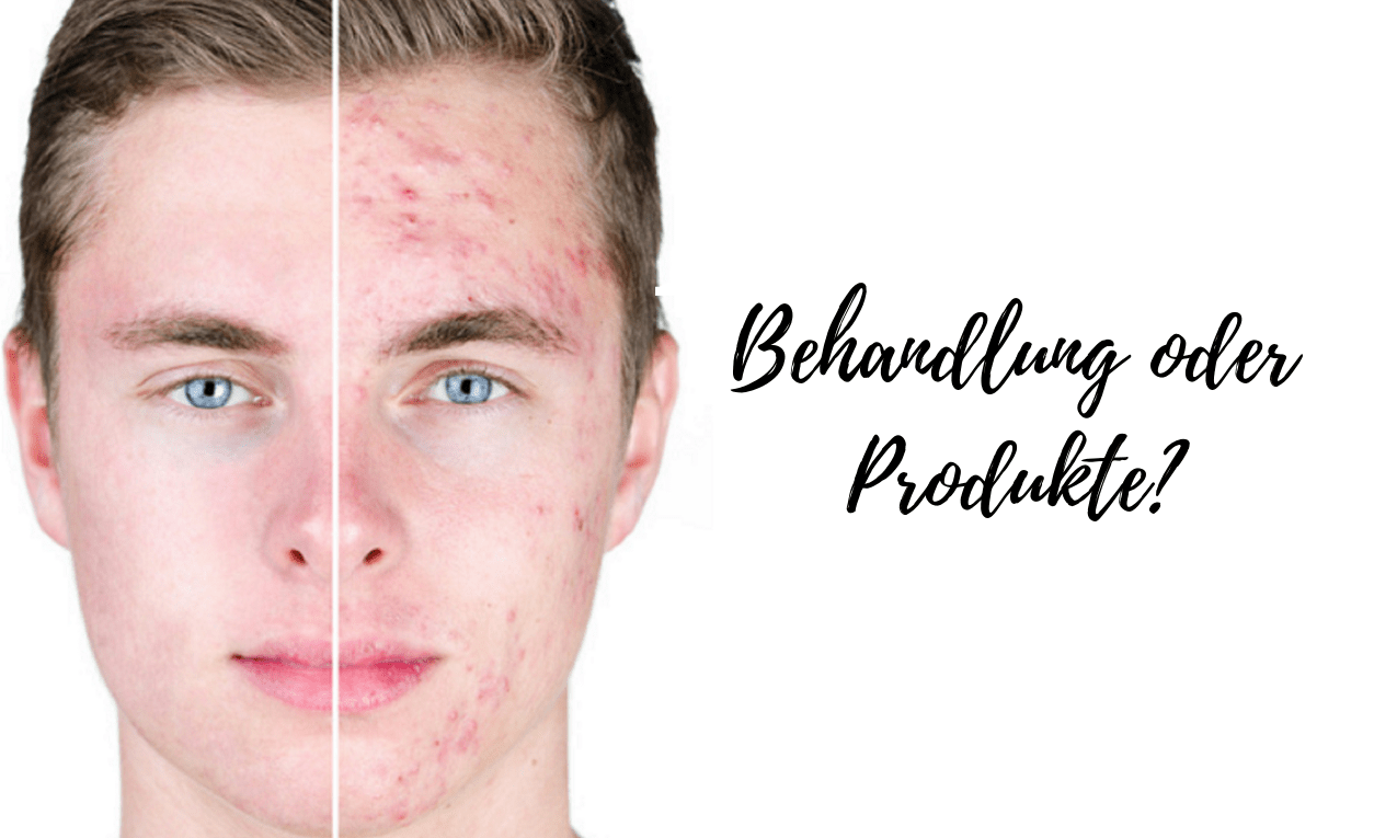 Aknebehandlung oder Produkte? - Pure Skin Concept GmbH